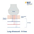 The ABCs Of Lung Ultrasound | A-lines | Veterinary Ultrasonography